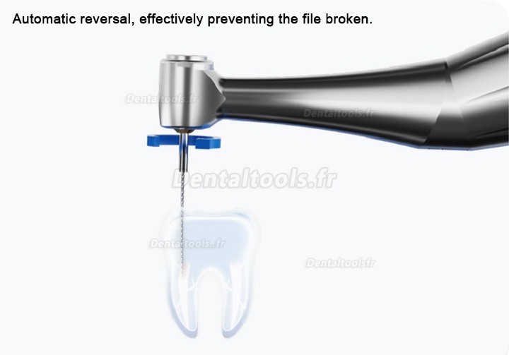 Refine Maxdo Moteur d'endodontie dentaire sans fil avec alternatif